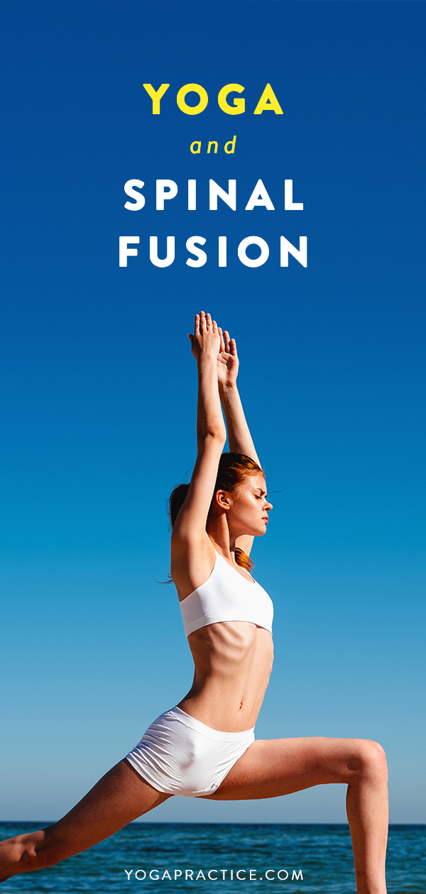 Spinal Fusion Archives YOGA PRACTICE